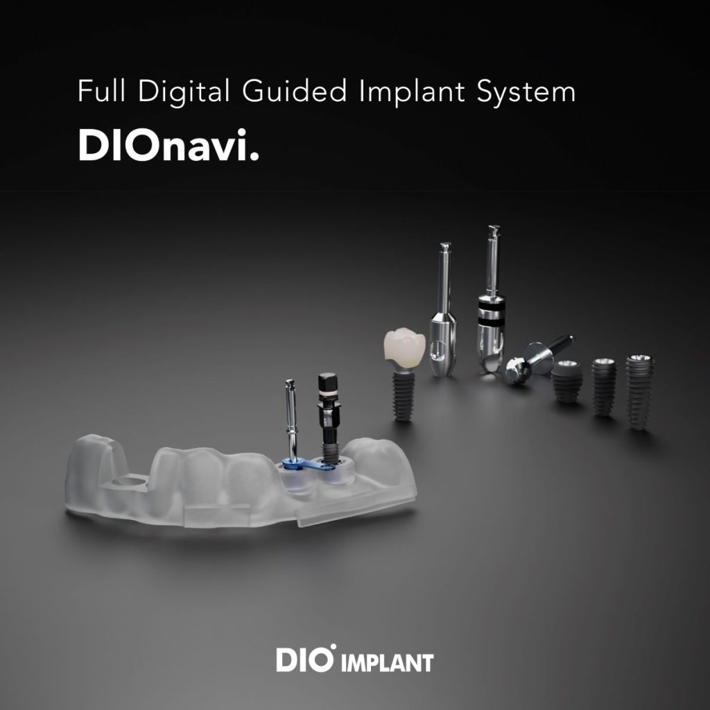 DIOnavi