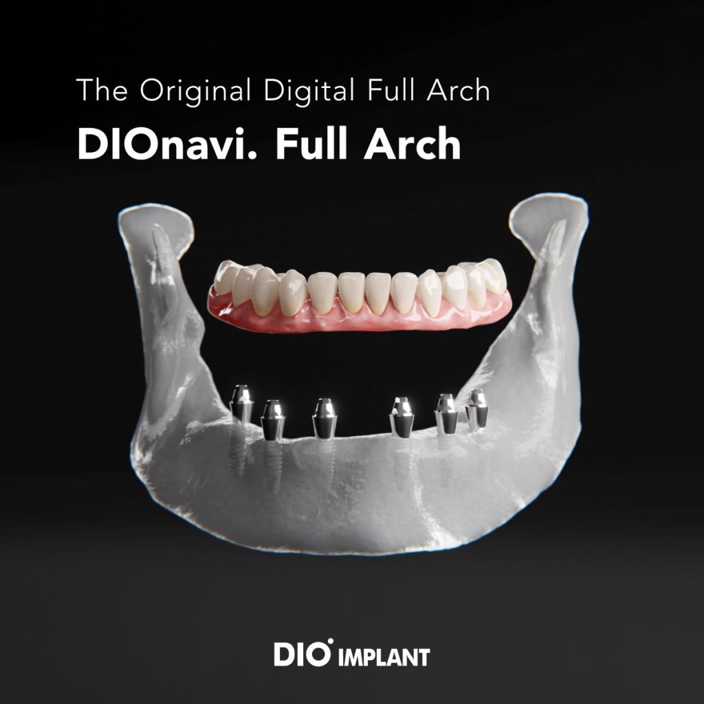 DIO navi Full Arch