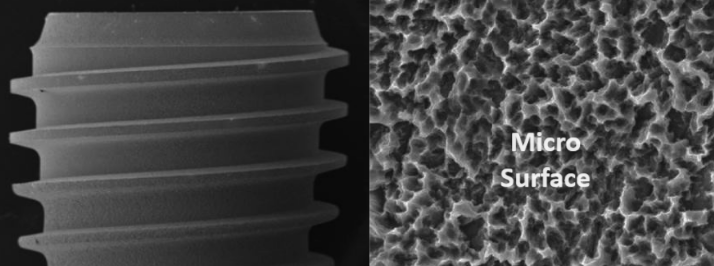 Upper Surface composition od dental Implants DIO