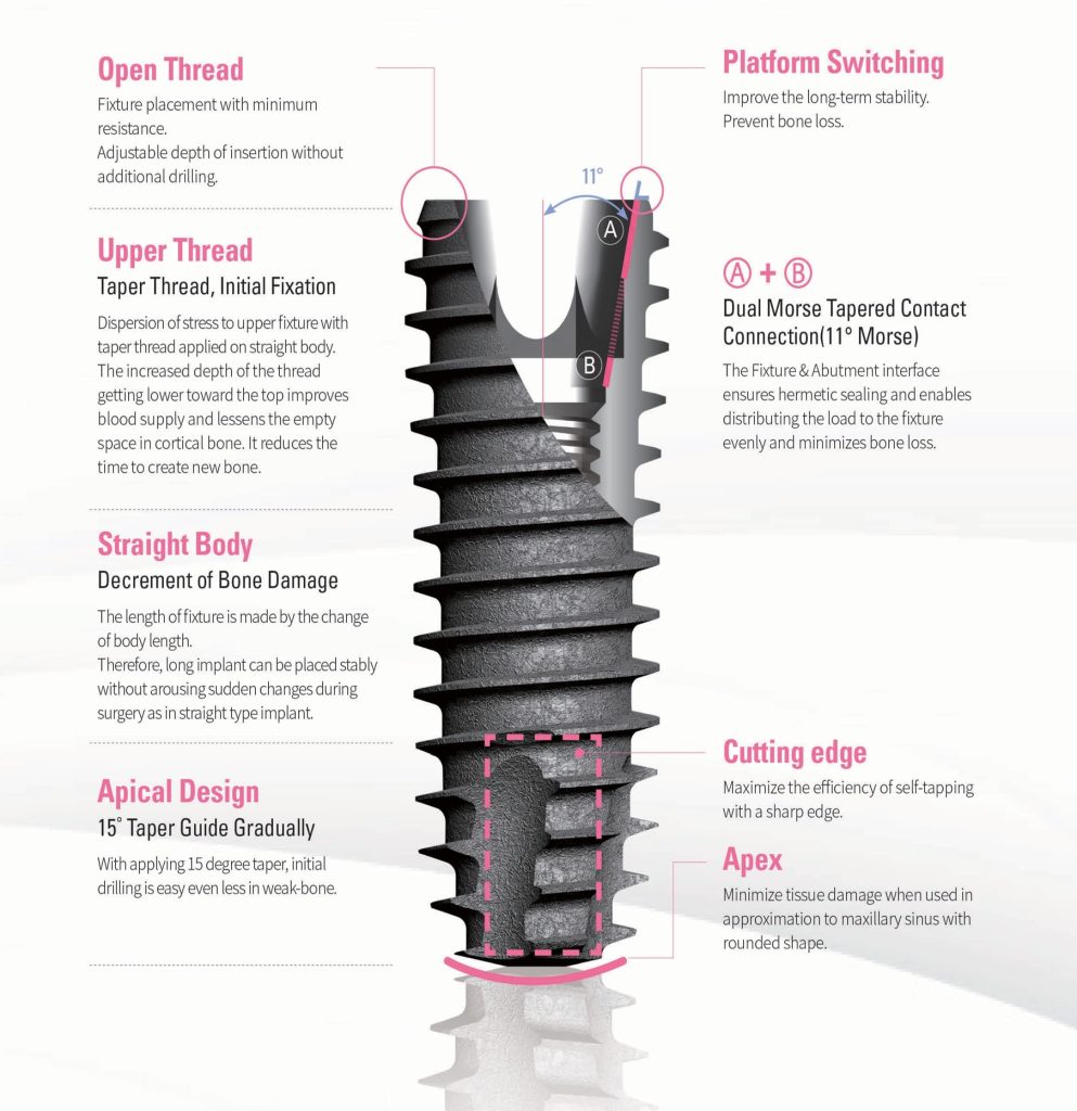 Caracteristics of Dental Implants DIO